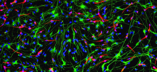 Cellules du cerveau. Image flickR CC license by GE Healthcare (Corey Seehus)